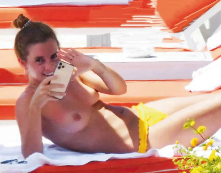 Emma Watson Nudes Topless Leaked Holiday Sunbathing Small Tits – LeakedOf.org